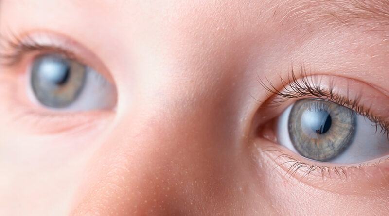 Ojos de un niño, estudio sobre epidemiología de glaucoma primario congénito