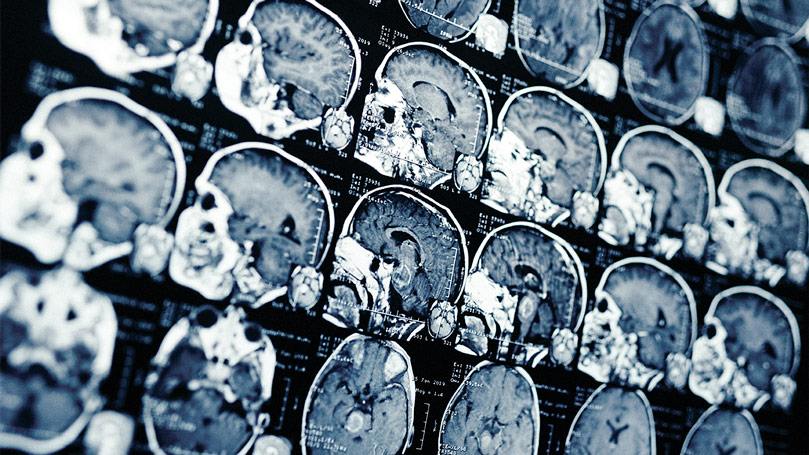 radiografía mostrando diferentes tomas de rayos x de una cabeza