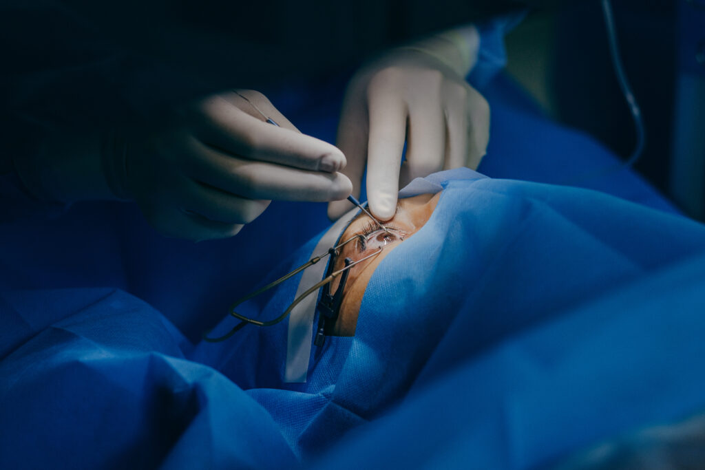 Cirugía de ojo para corrección de vista prótesis visuales