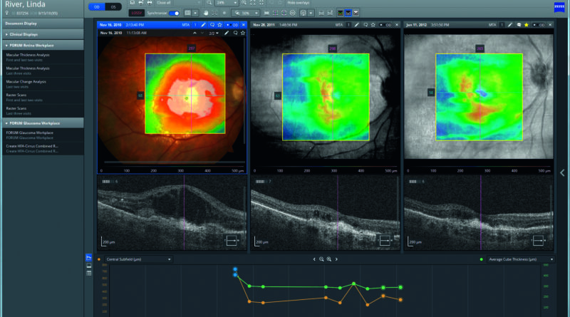 Digital integration of clinical eye examinations